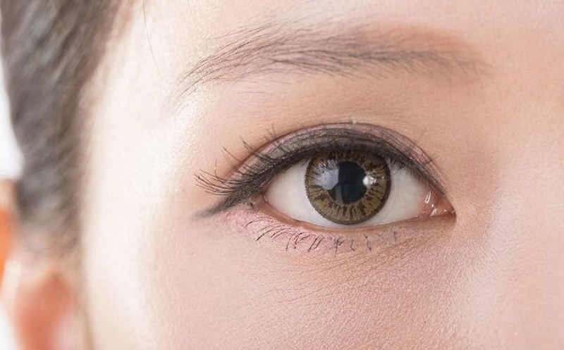 Cảnh báo Đây là những điều bạn phải biết về sửa xăm mí mắt